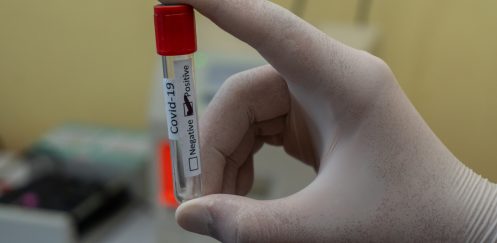Alemania obliga a realizar el test del COVID-19 para entrar en el país